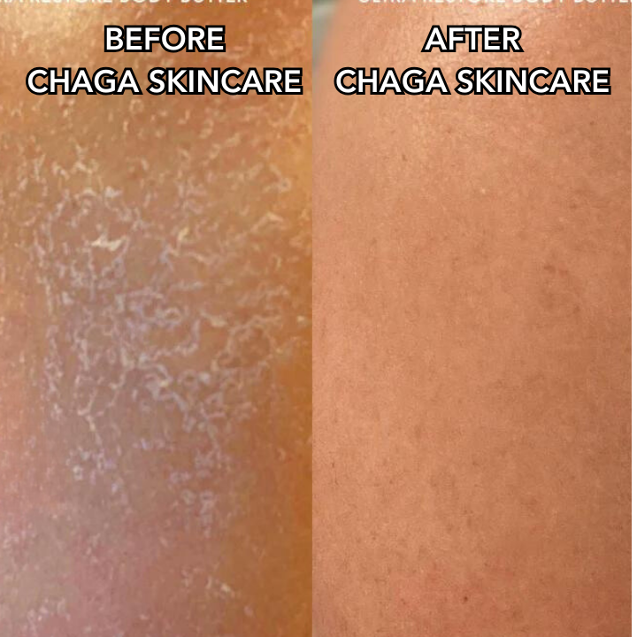 Chaga Skincare Set